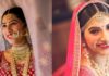 Get brighter and white teeth before your big day