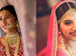 Get brighter and white teeth before your big day