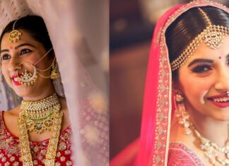 Get brighter and white teeth before your big day