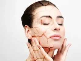 Top 4 Trusted Remedies for Brides with Dry Skin dry skin