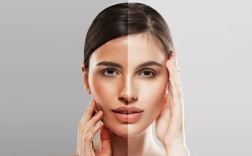 Easy Tricks to Avoid & Remove Summer Tan This Wedding Season Summer Tan